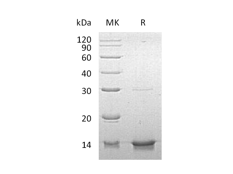 Recombinant Human DYNLL1 (N-6His)