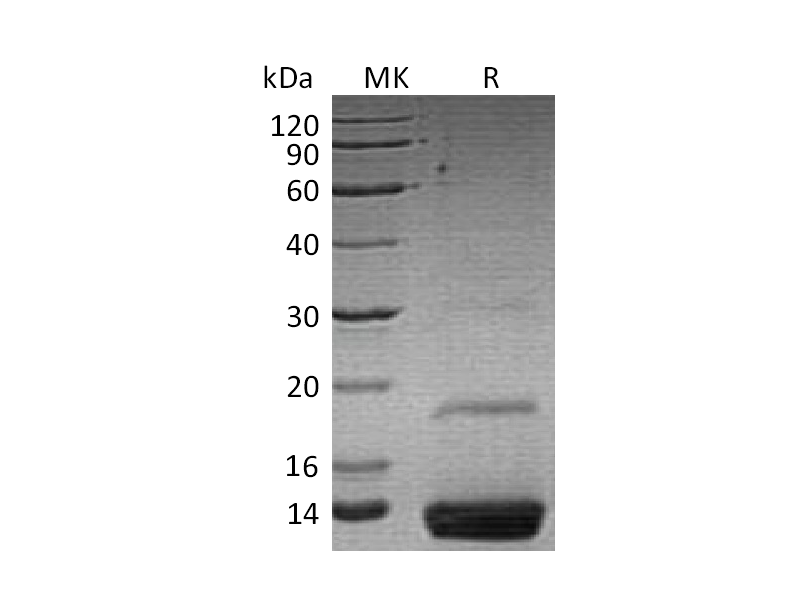 Recombinant Human Resistin (C-6His)