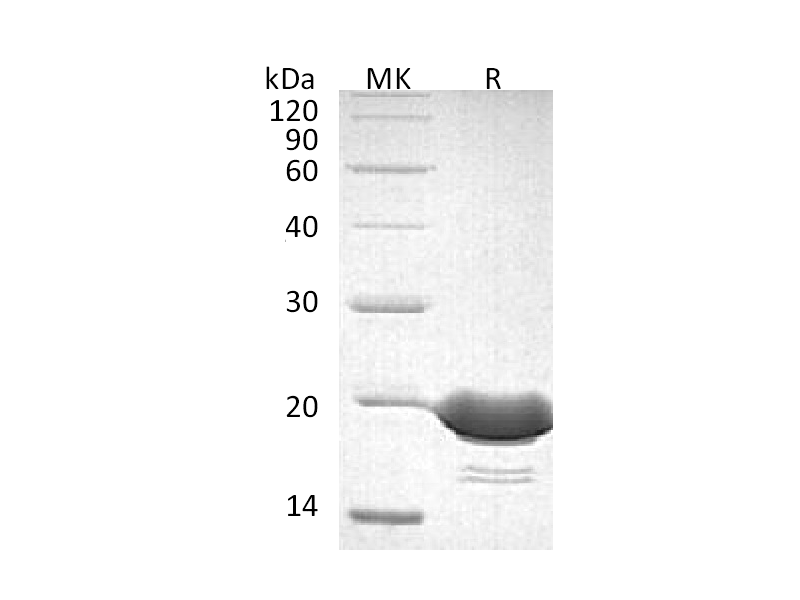Recombinant Human 4-1BBL (C-6His)