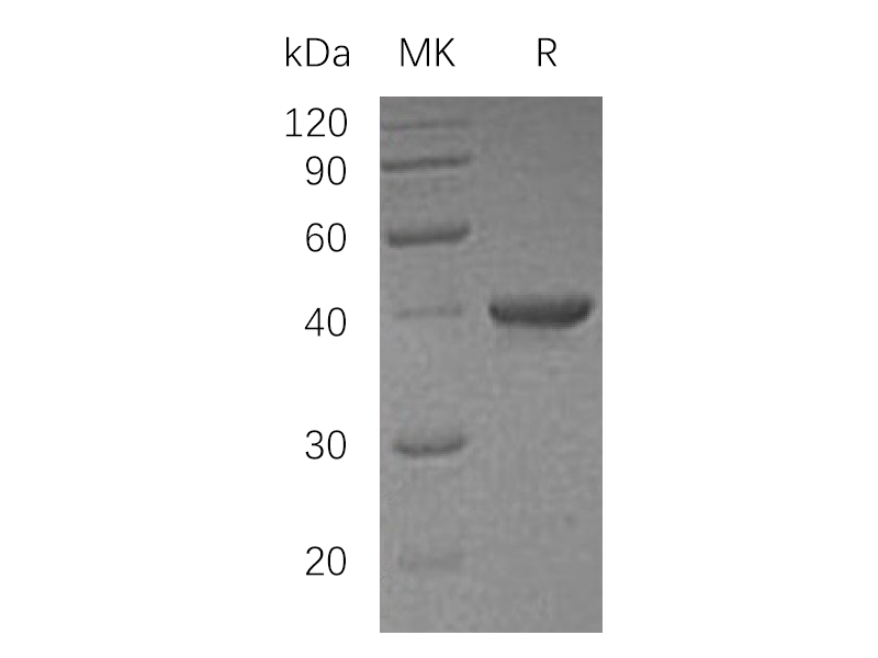 Recombinant Human UBE2I (N-GST)