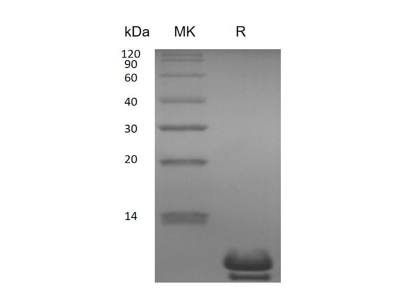Recombinant Human UGRP1