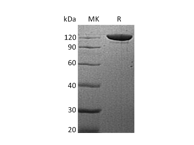Recombinant Human Vinculin