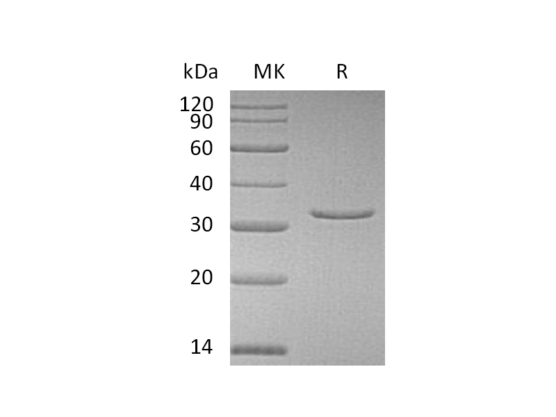 Recombinant Human VSNL1 (N-6His)