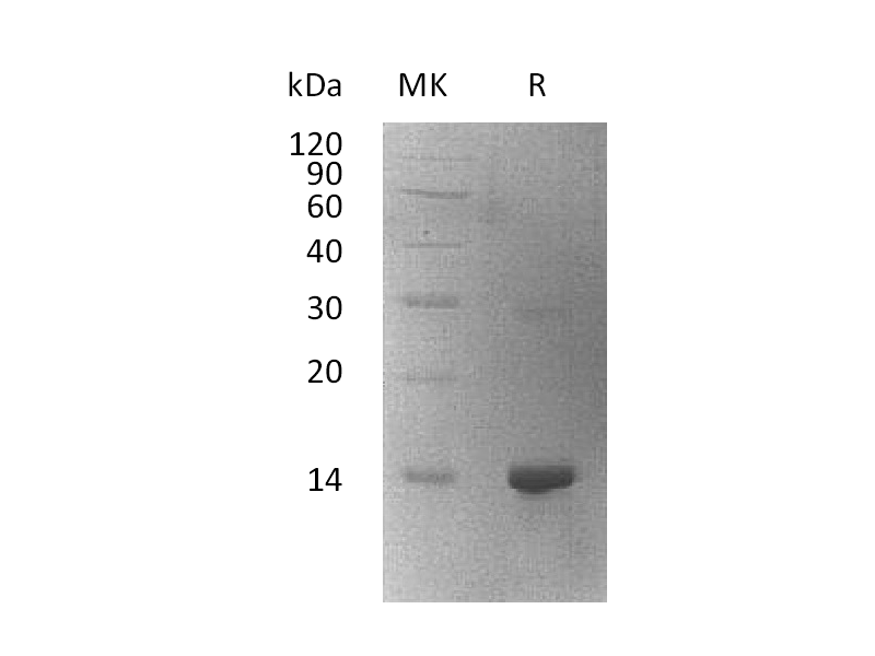 Recombinant Human WBP2 (N-6His)