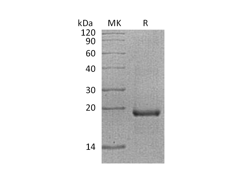 Recombinant Human EGR1 (N-6His)