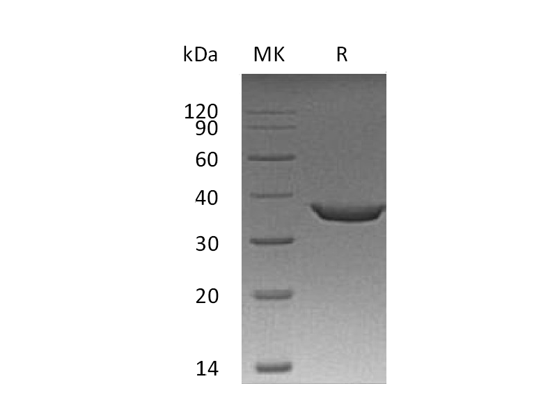 Recombinant Human Sting (N-Sumo-6His)