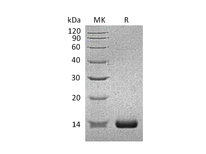 Recombinant Human SAA2 (N-6His)