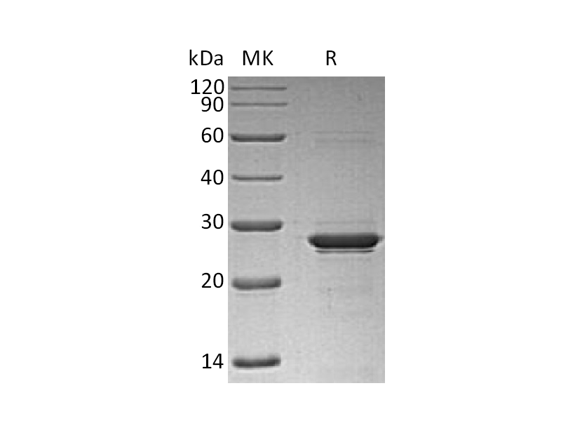 Recombinant Human OSM (N-6His)