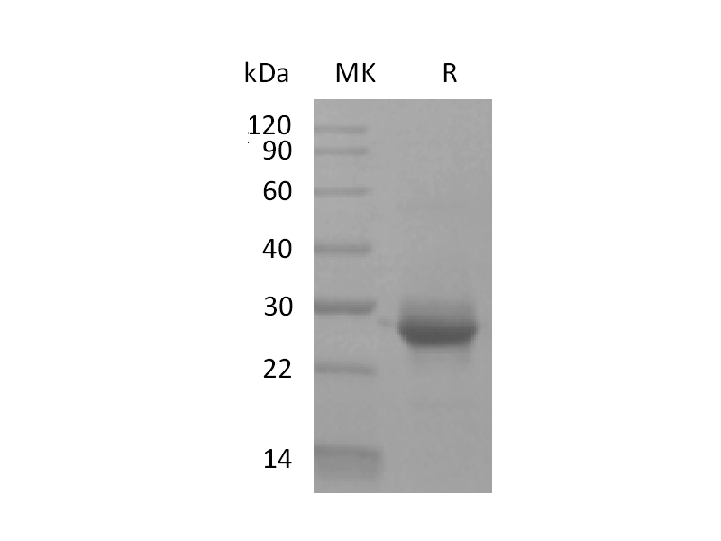 Recombinant Human KRAS (G12V, N-6His)