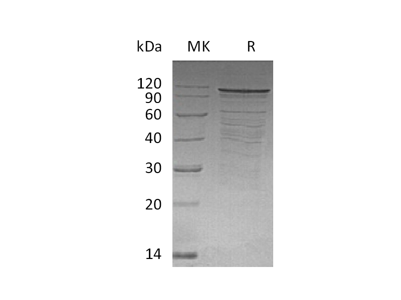 Recombinant Rat PSD-95 (N-6His)