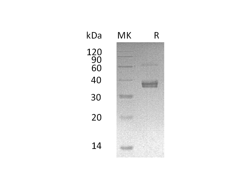 Recombinant Human ADAMDEC1 (C-6His)