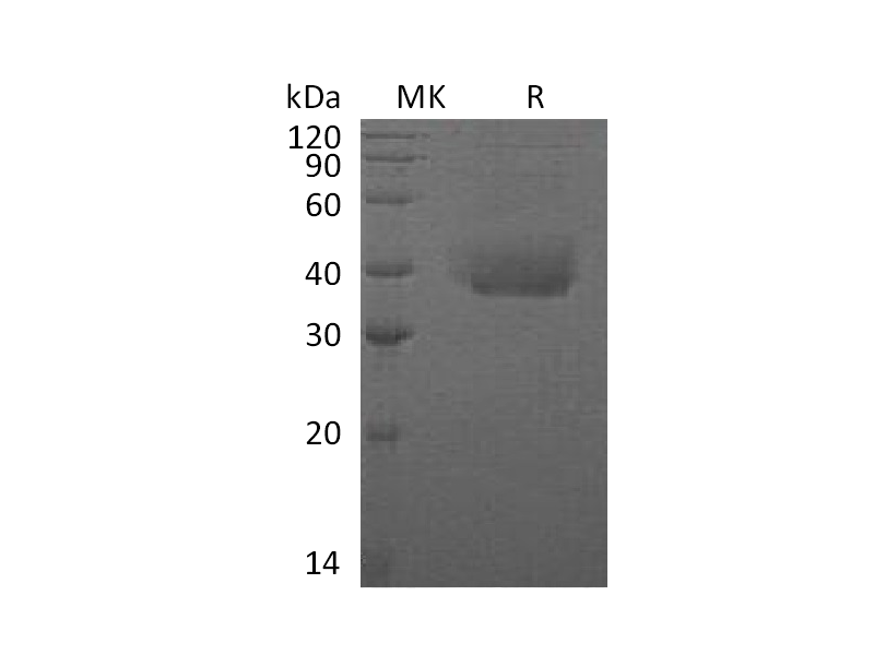 Recombinant Human ANTXR1 (C-6His)