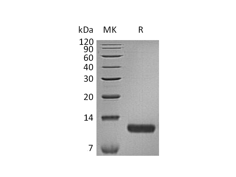 Recombinant Human CCL17 (C-6His)