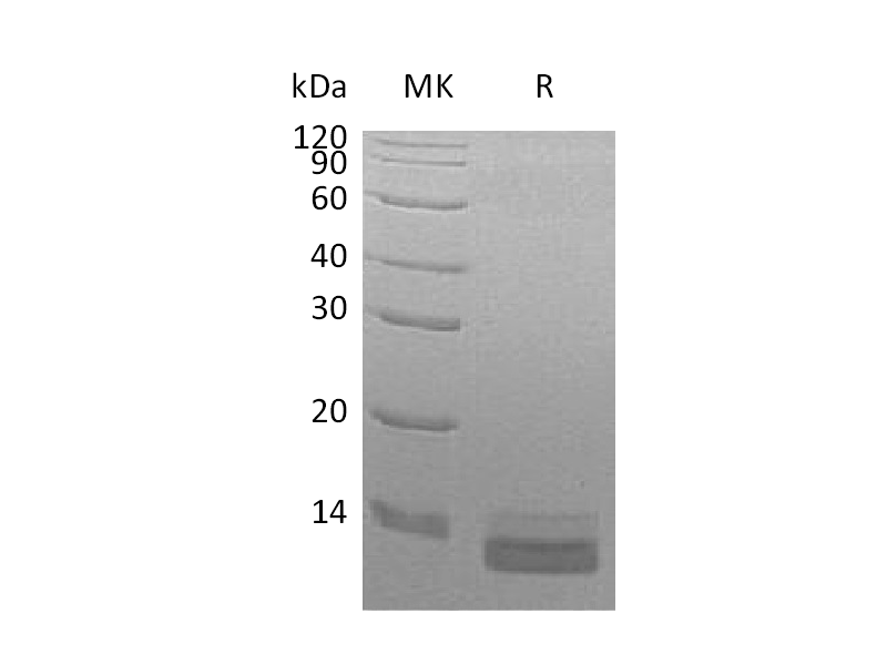 Recombinant Human CCL14 (C-6His)