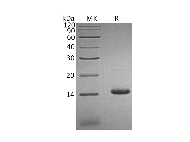 Recombinant Human CCL3L1 (C-6His)