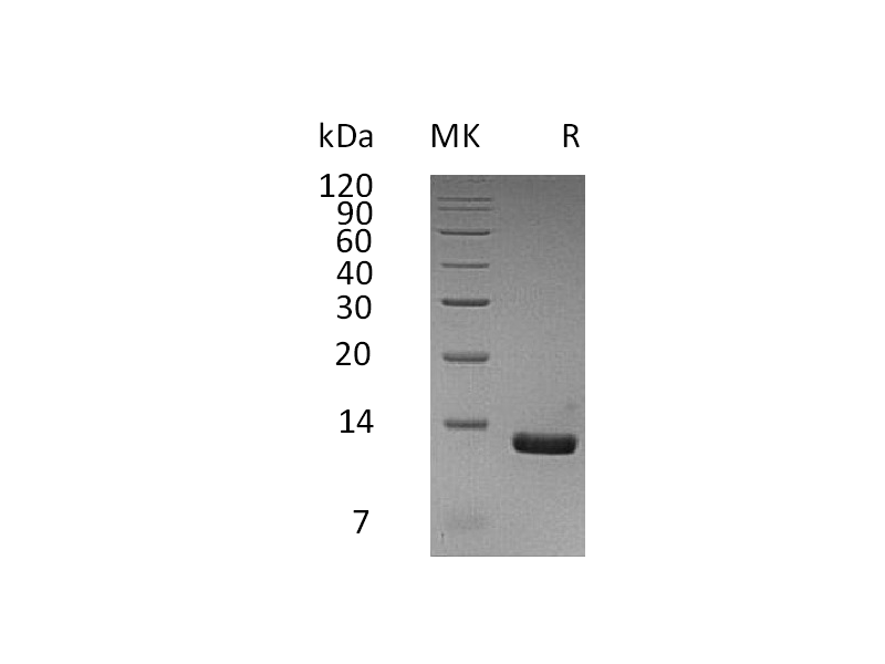 Recombinant Human CCL8 (C-6His)