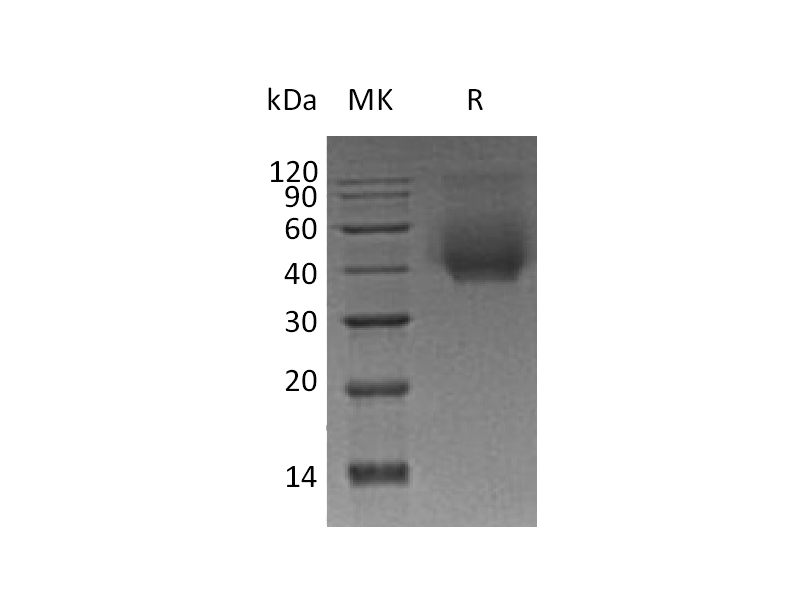 Recombinant Human CD44 (C-6His)