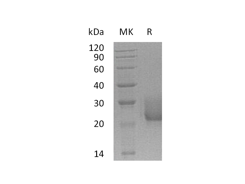 Recombinant Human CEACAM7 (C-6His)