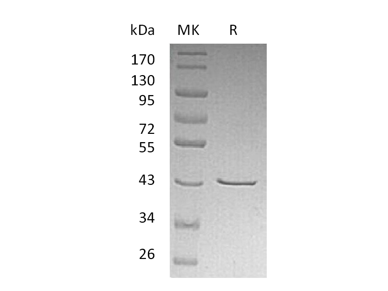 Recombinant Human CHI3L2 (C-6His)