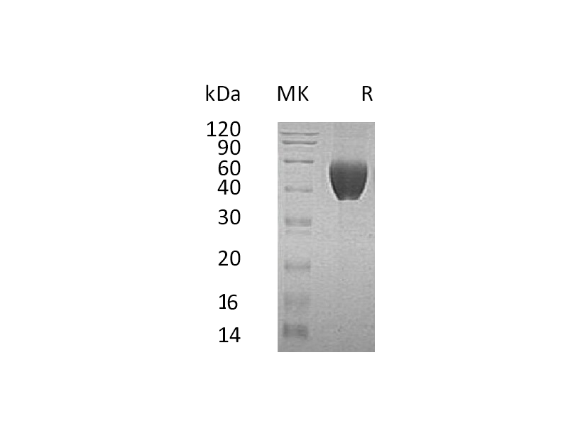 Recombinant Human FSTL1 (C-6His)