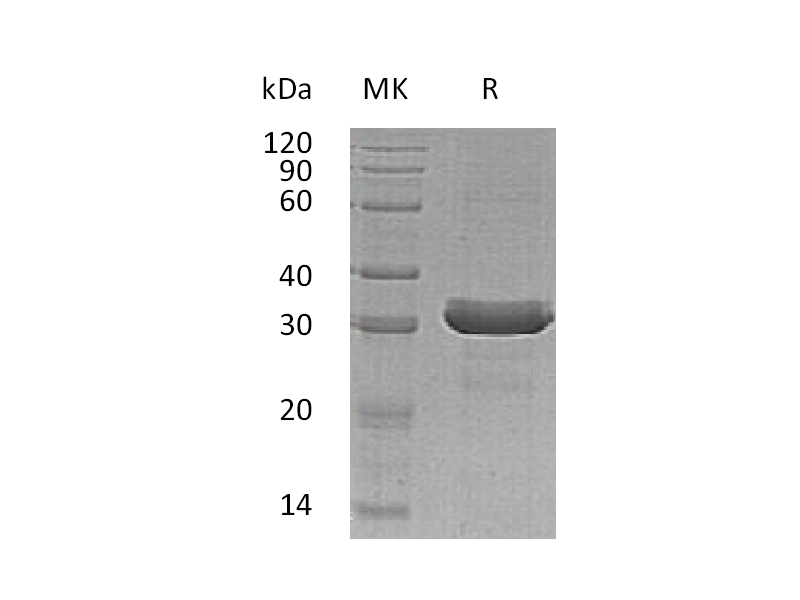 Recombinant Human HDGFRP3 (C-6His)
