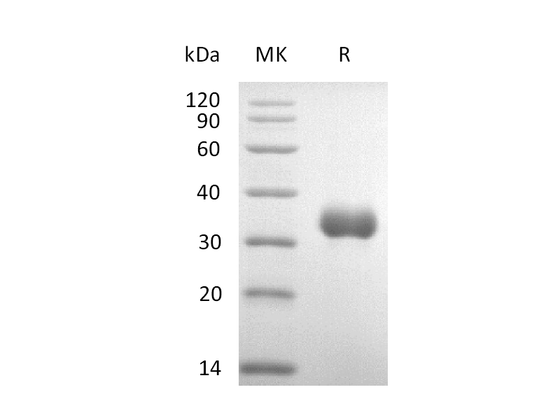 Recombinant Human IGFBP-7 (C-6His)