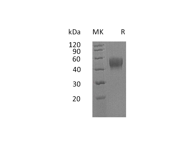 Recombinant Human IL-10RB (C-6His)