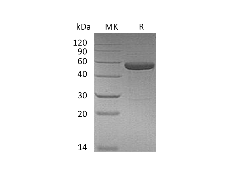 Recombinant Human IL-15RA&IL-15 (C-Fc)