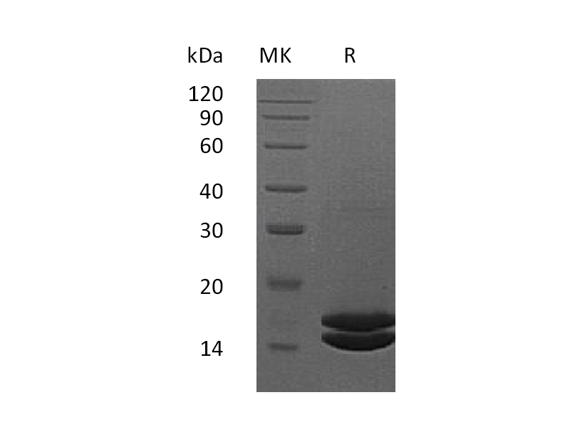Recombinant Human IL-2 (C-6His)