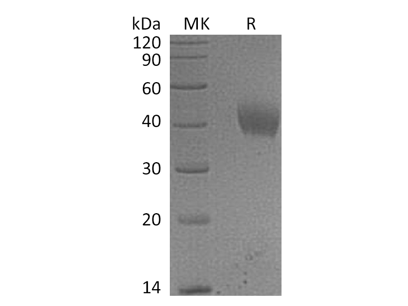 Recombinant Human IL-20RA (C-6His)