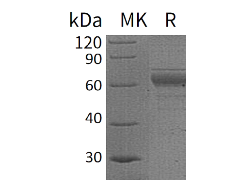 Recombinant Human IL-20RB (C-Fc)