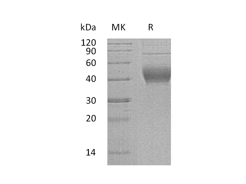 Recombinant Human IL-22RA2 (C-6His)