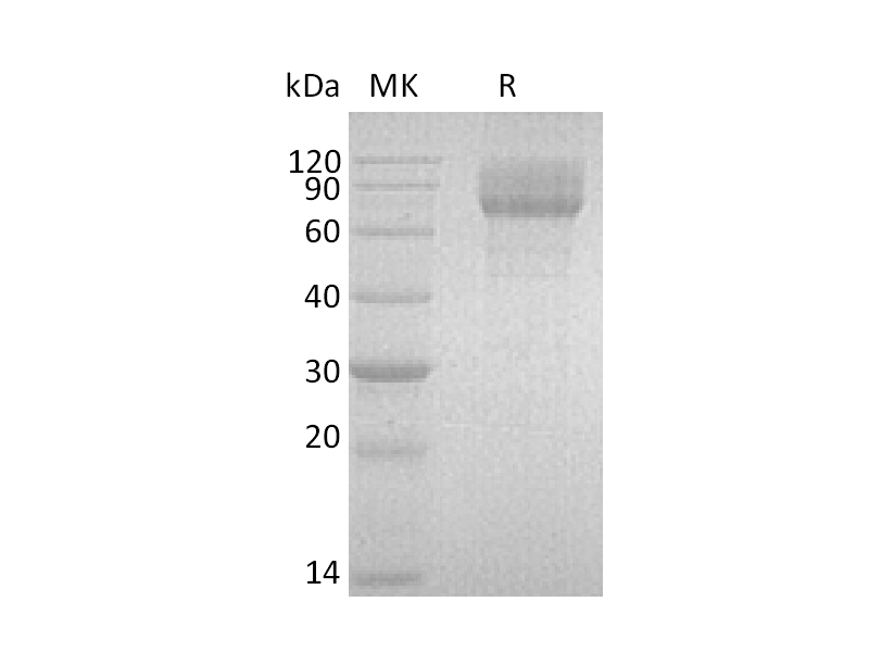 Recombinant Human IL-22RA2 (C-Fc)