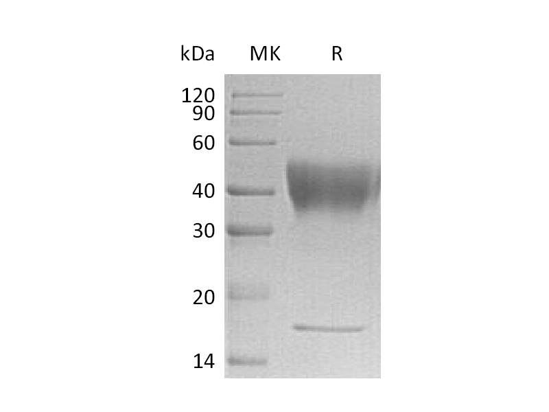 Recombinant Human IFNGR1 (C-6His)