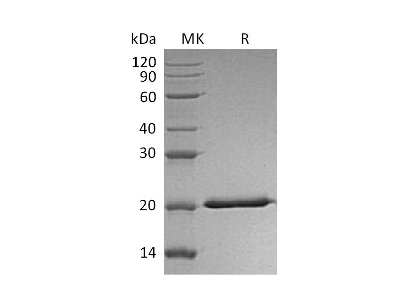Recombinant Human IL-28A (C-6His)