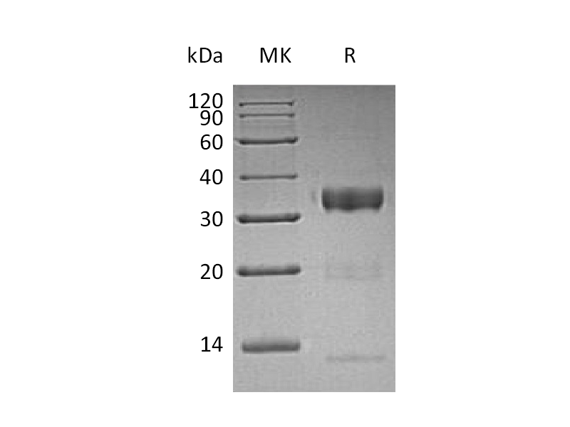 Recombinant Human KLK10 (C-6His)