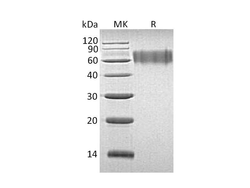 Recombinant Human LYPD3 (C-6His)
