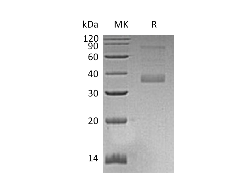 Recombinant Human MFAP4 (C-6His)