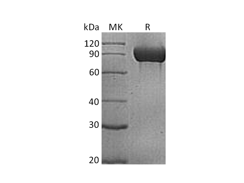 Recombinant Human PECAM-1 (C-6His)
