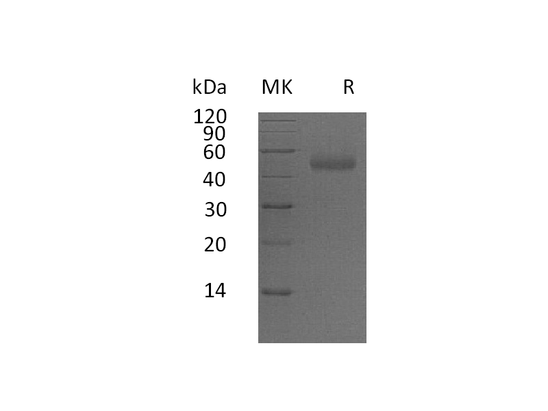 Recombinant Human PSG5 (C-6His)