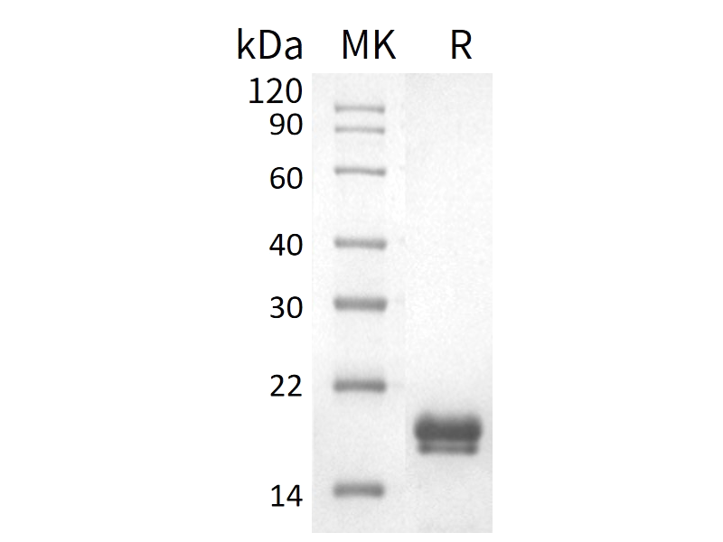 Recombinant Human REG1A (C-6His)