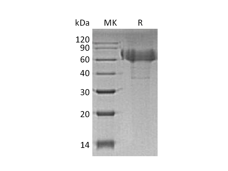 Recombinant Human TIM-4 (C-6His)