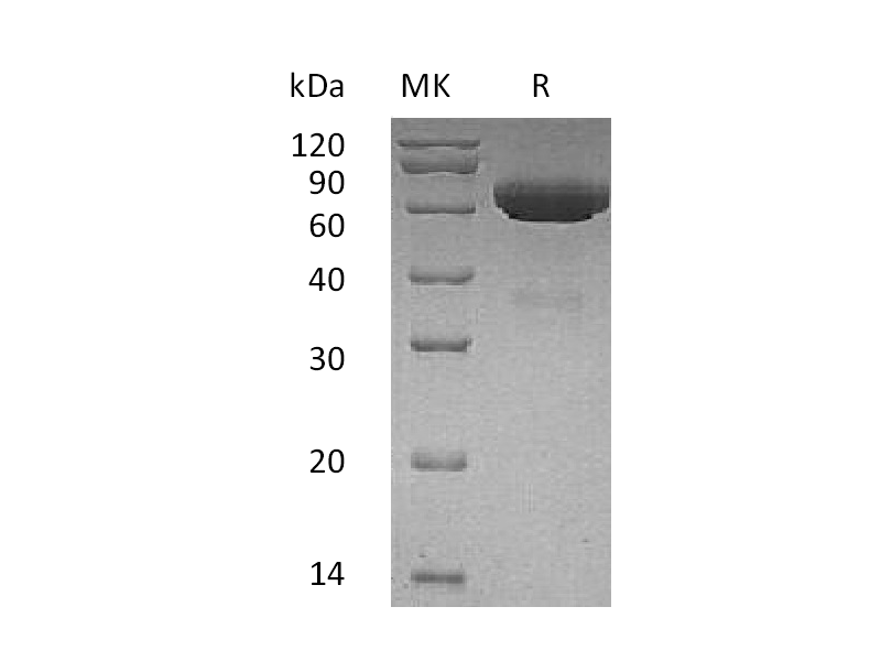 Recombinant Human tPA (C-6His)