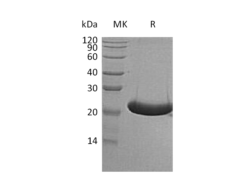 Recombinant Human TREML1 (C-6His)