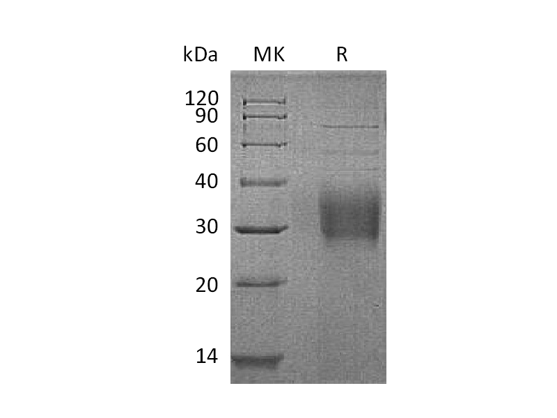 Recombinant Human TROP-2 (C-6His)