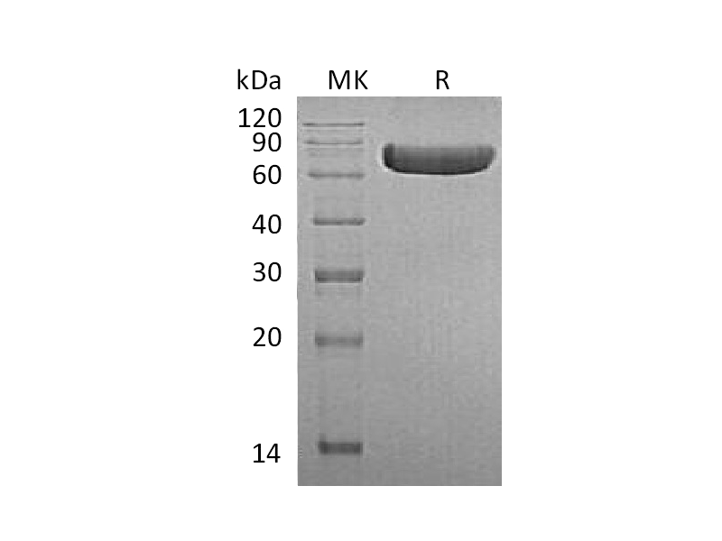 Recombinant Human TNF RII (C-Fc)