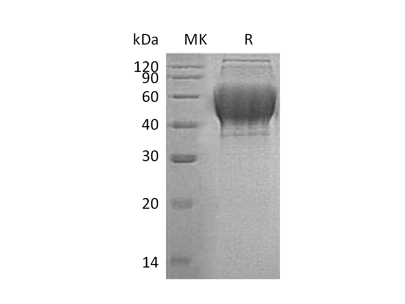 Recombinant Human TXNDC15 (C-6His)
