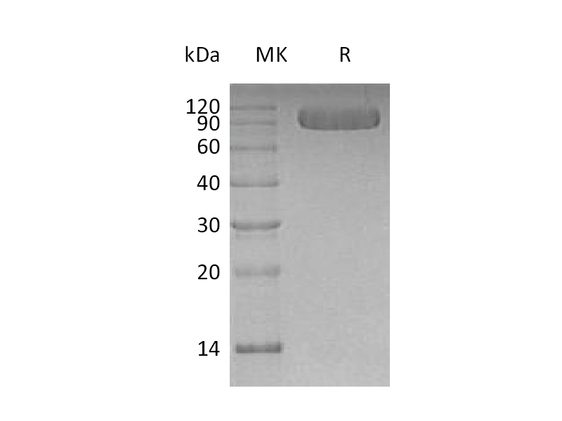 Recombinant Human Vasorin (C-6His)