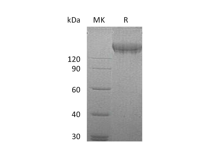 Recombinant Human VEGFR2 (C-Fc)