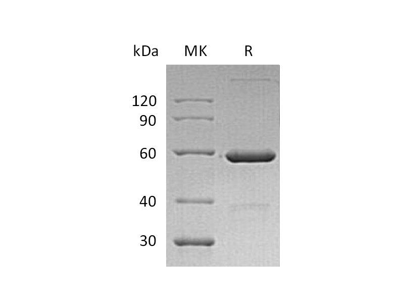 Recombinant Human VSIG8 (C-Fc)
